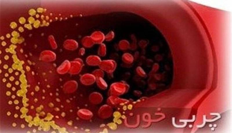 /public/files/shares/آب غوره و آبلیمو چربی‌خون را پ_1678913108.jpeg